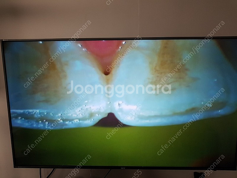 전자현미경처분합니다/치아,피부등 미세관찰용입니다[10,...--2