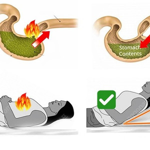 역류성식도염 베개 휴대용 접이식 군대 배게 다리 올리는 쿠션 부종 예방