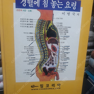 경혈에 침 놓는 요령