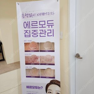 부산 서면 데자뷰 메디스킨 380만원 회원권 양도