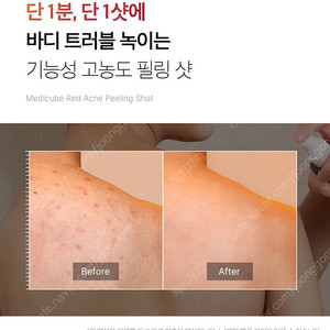 메디큐브 신제품 레드 아크네 바디필링샷