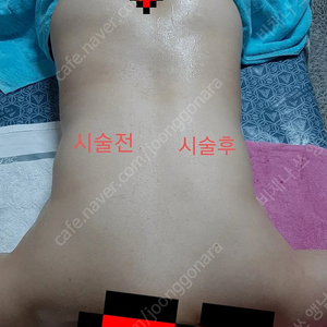 비채나 비움 비궁 심부발열기