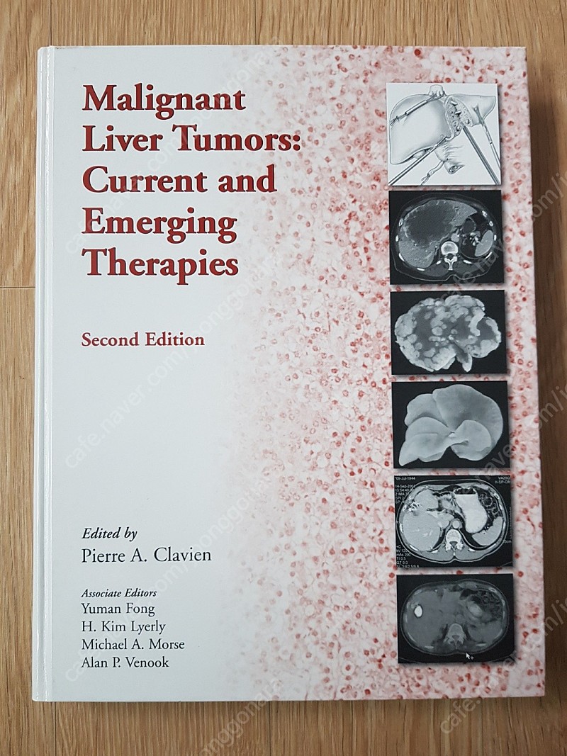 [의학도서,의학서적] Malignant Liver Tumors: Current And Emerging Therapies(외과 책, 영상의학과 책)판매합니다.