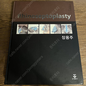 [의학서적, 의학전문서적, 의학도서] Rhinoseptoplasty 장용주 군자출판사