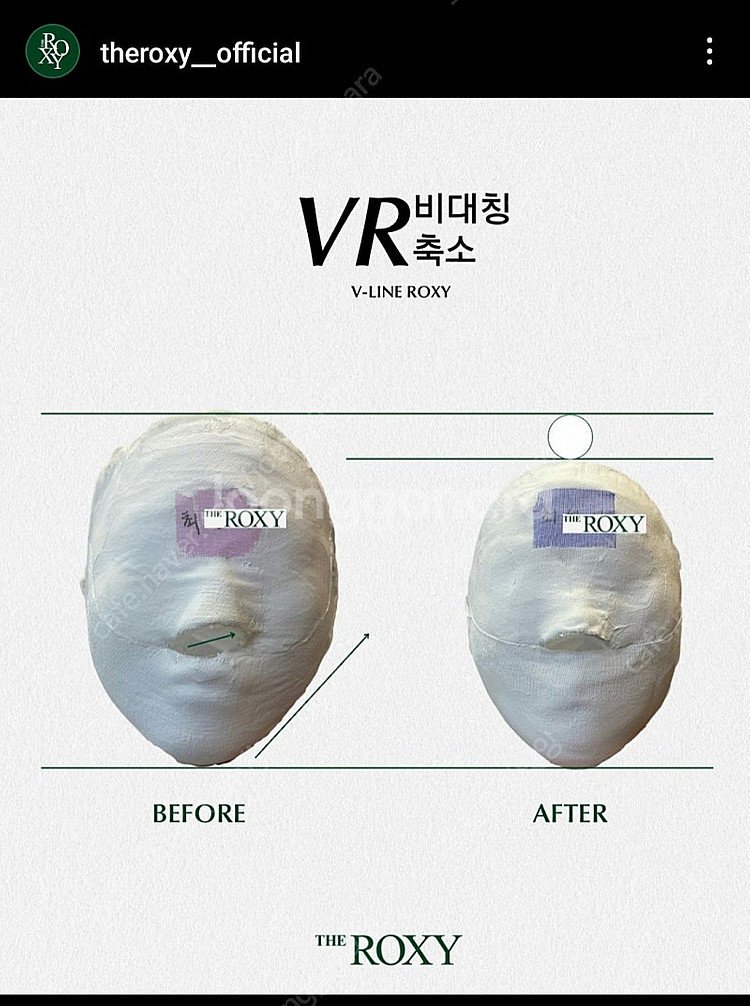 (양도) 연예인샵 경락 VR비대칭관리+얼굴축소+미백+화...--1