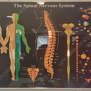 척추 신경 싸인 보드 판매합니다.