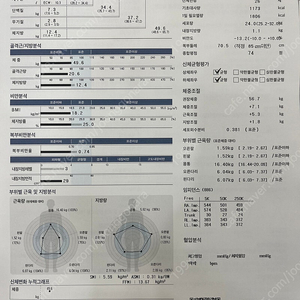 레아쥬 기계