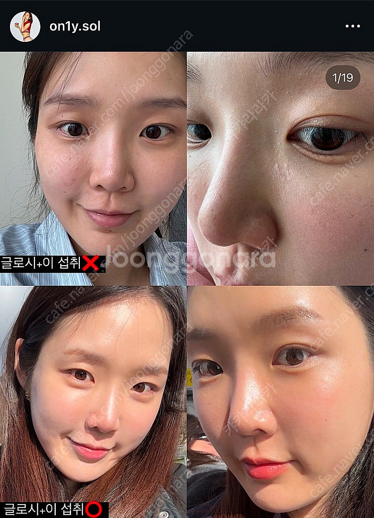 이너뷰티 글로시+글로이--0