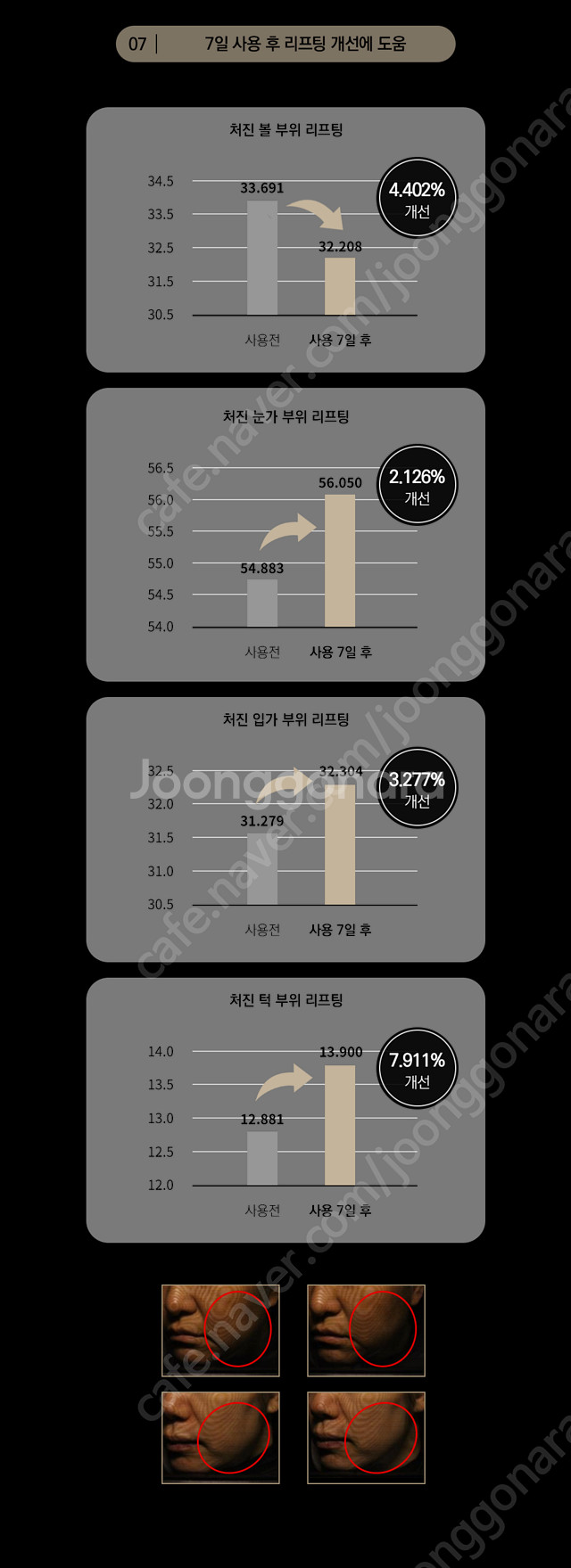 ODEAR 오데어 엔더믹 5MGF 크림--6