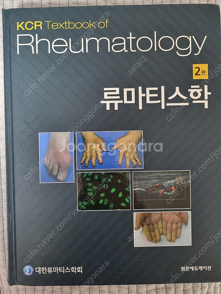 [의학도서] 류마티스학 2판/대한류마티스학회/범문에듀케...--0