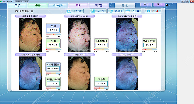 피부진단기 야누스2 안면검사기 피부분석기 JANUS-2--3