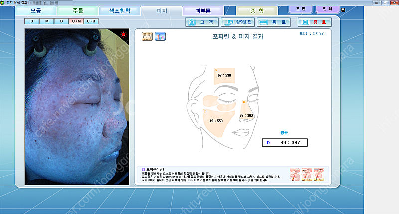 피부진단기 야누스2 안면검사기 피부분석기 JANUS-2--0