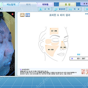 피부진단기 야누스2 안면검사기 피부분석기 JANUS-2