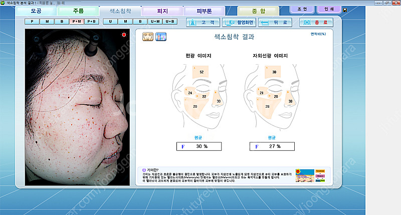 피부진단기 야누스2 안면검사기 피부분석기 JANUS-2--4