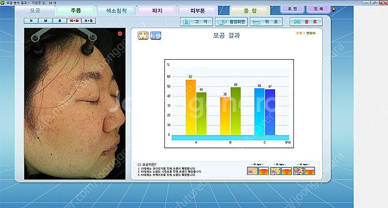 피부진단기 야누스2 안면검사기 피부분석기 JANUS-2--6