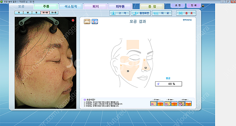 피부진단기 야누스2 안면검사기 피부분석기 JANUS-2--7