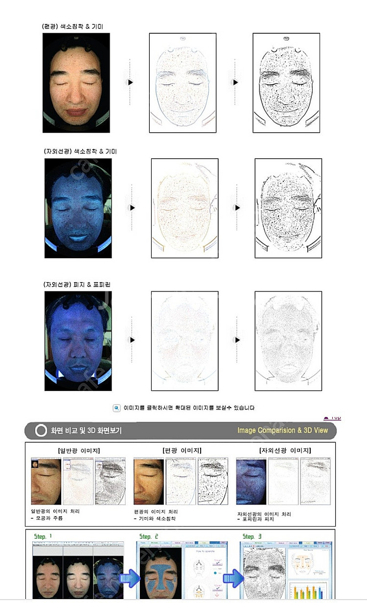 피부진단기 야누스2 안면검사기 피부분석기 JANUS-2--9