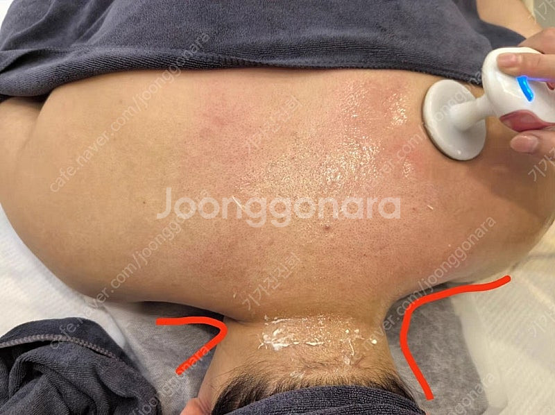 에스테틱용 확실한 고주파 마사지기--8