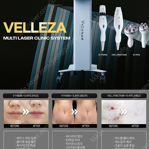 벨레자 미용기기 에스테틱,가정사용가능 정상가7-800만원
