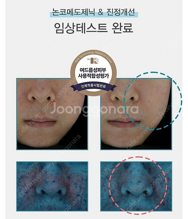 아크픽셀(트러블,홍조,문제성피부 타파)--3