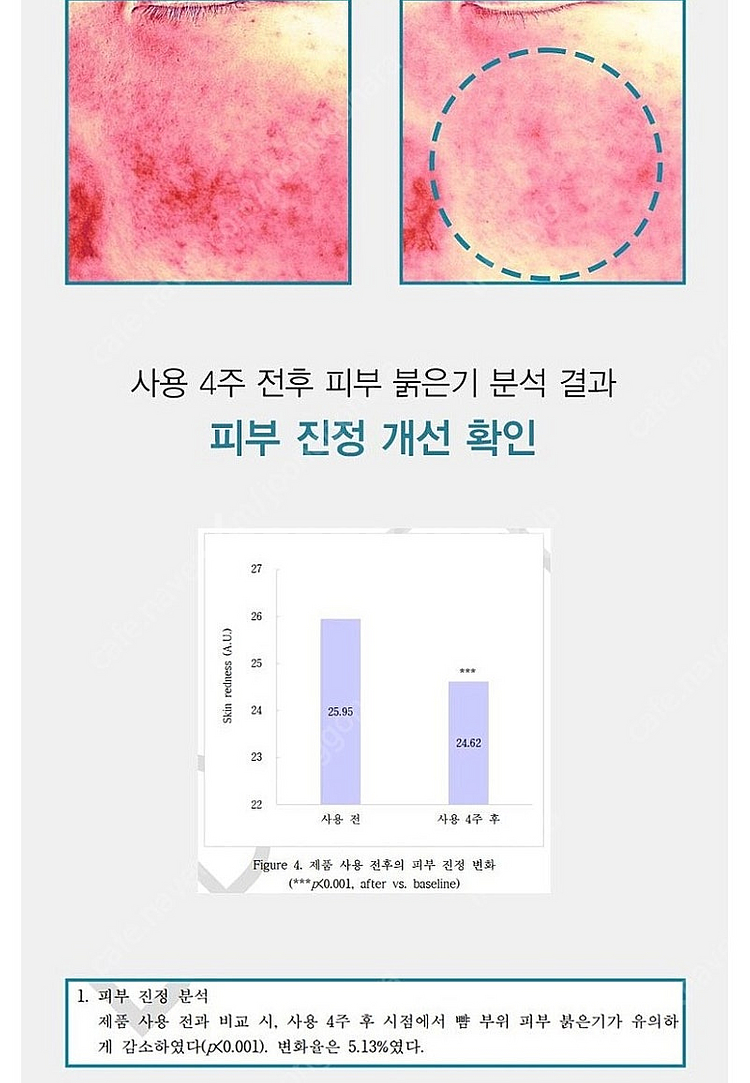 아크픽셀(트러블,홍조,문제성피부 타파)--6