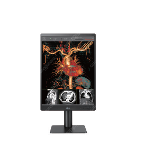 LG 3MP 판독모니터--0