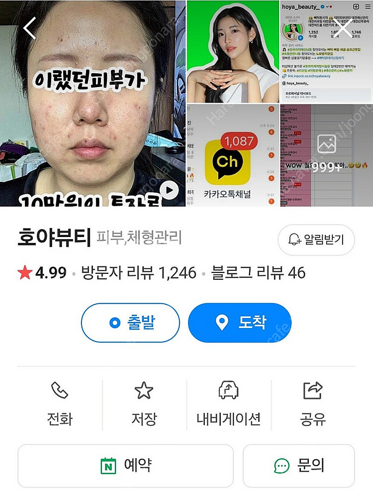 예신관리로 유명한 대전 호야뷰티샵 얼굴관리권 양도합니다...--0