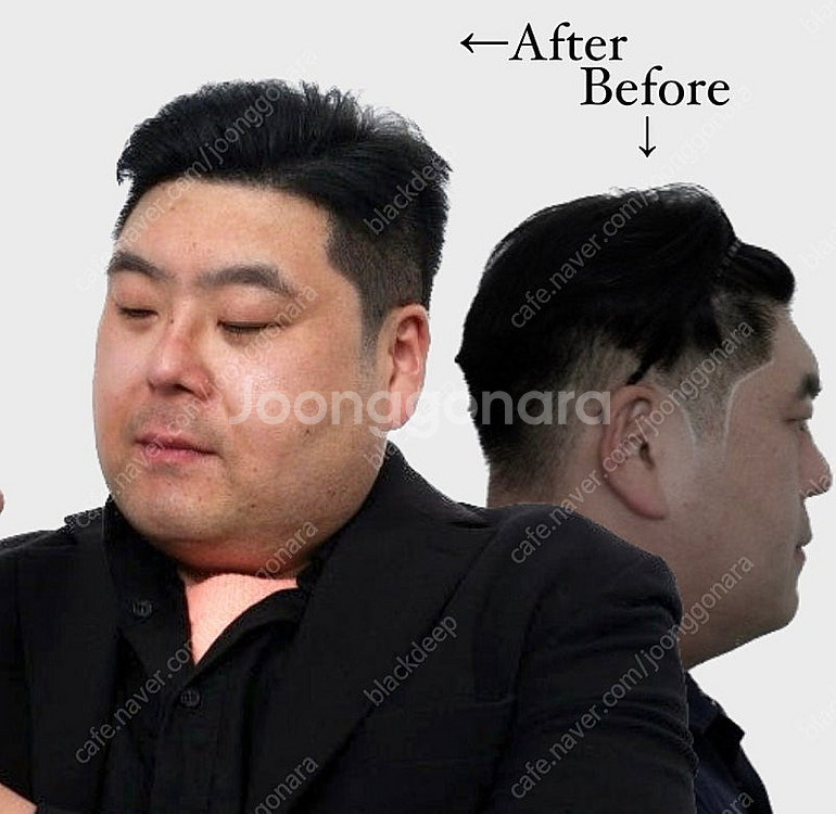 대구 두피문신 smp 가르마/정수리/헤어라인/탈모/m자...--6
