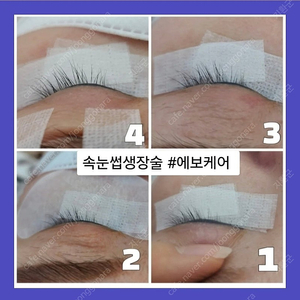 속눈썹 생장술, 탈모 영양관리 세럼 앰플