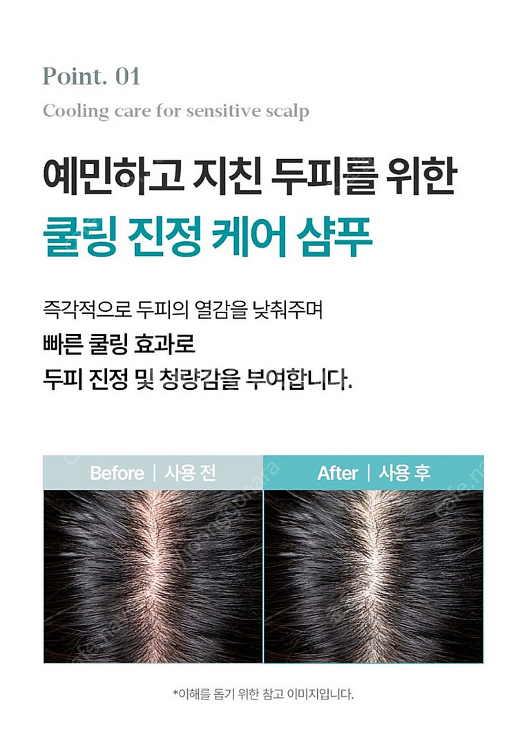 리프레쉬 쿨샴푸 [두피에 열이 많으면 탈모가 생길 가능...--2