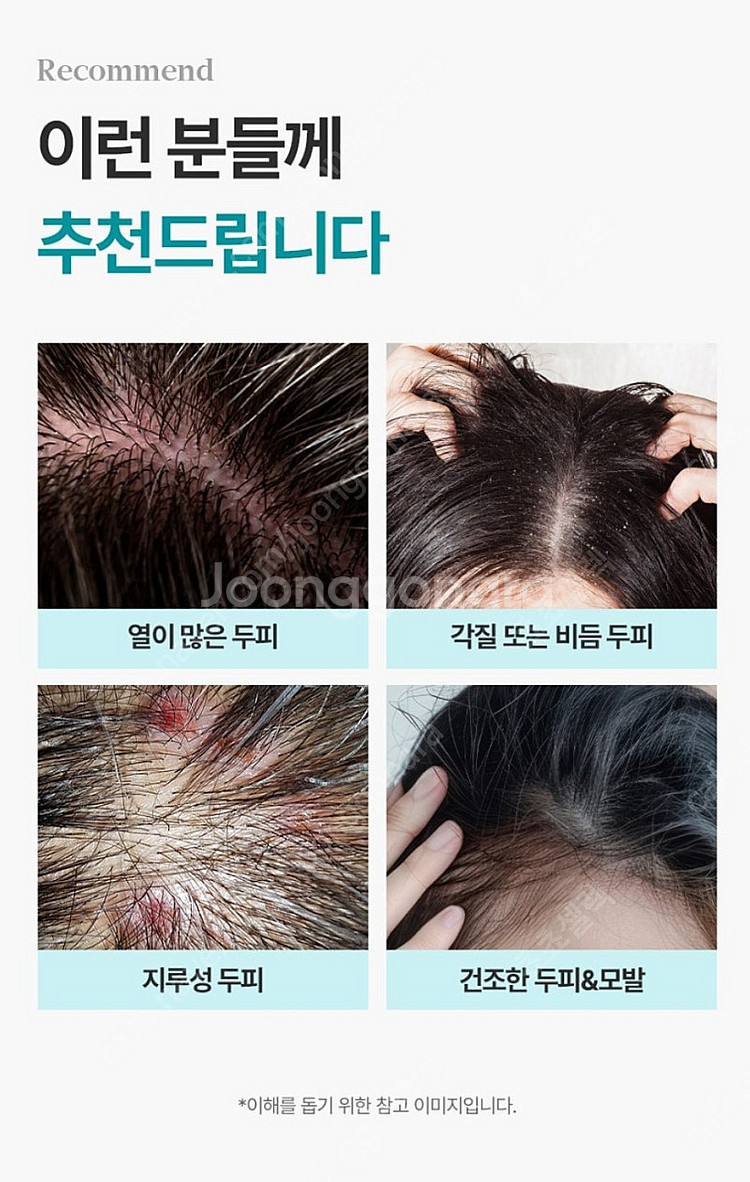 리프레쉬 쿨샴푸 [두피에 열이 많으면 탈모가 생길 가능...--6