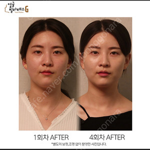 얼굴필라테스바이지 5회+바디스크럽 마사지 1회