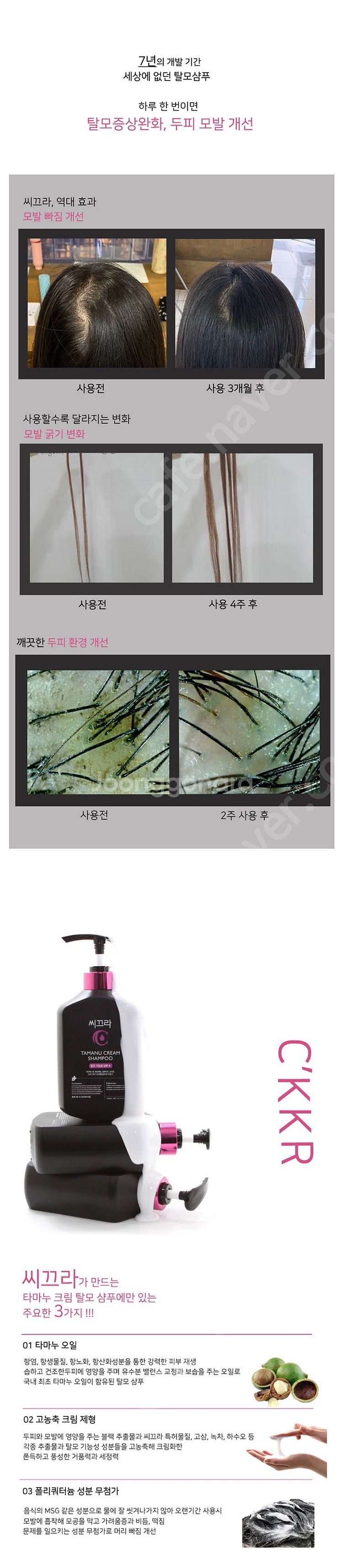 시그라 탈모샴푸 급처 합니다3--3