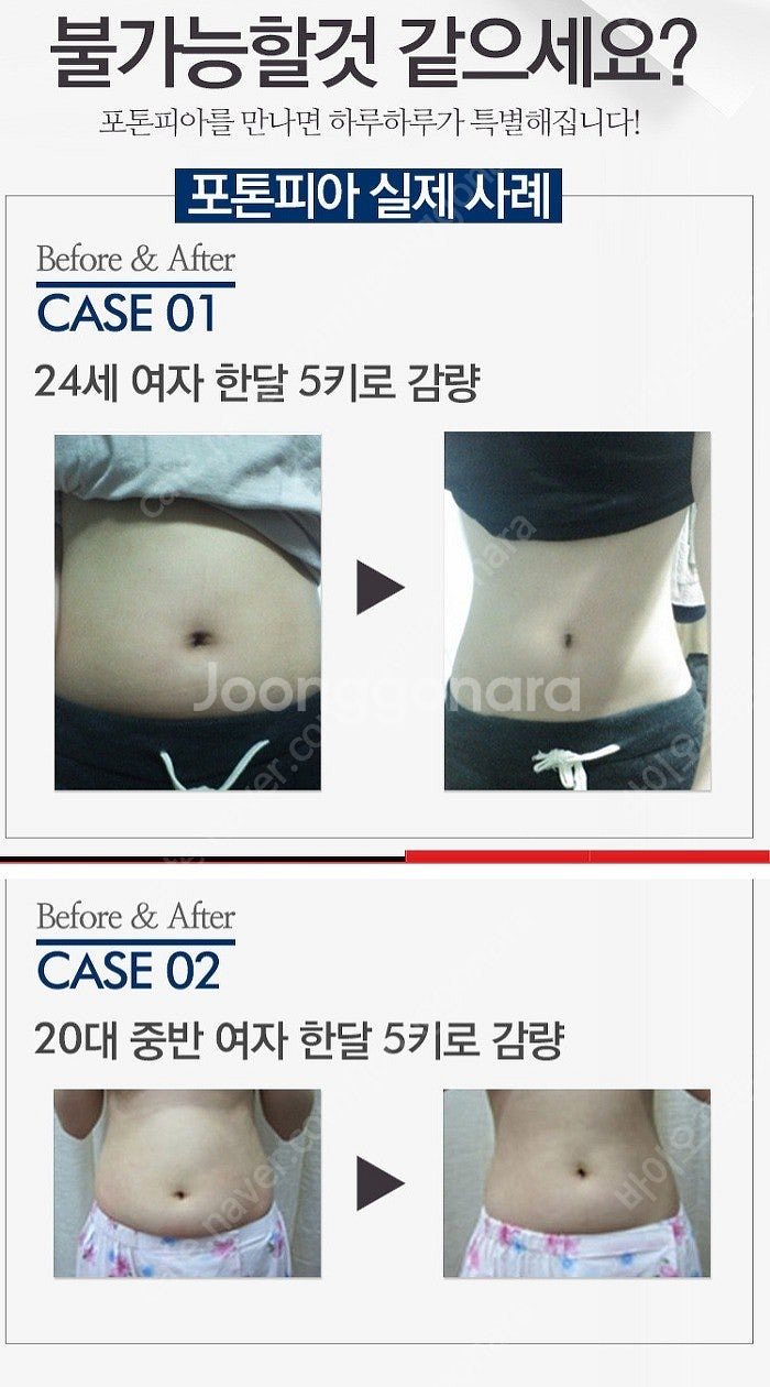 바이오포톤 전신돔4.5최하가(17.8년,의정부,AS1년...--6