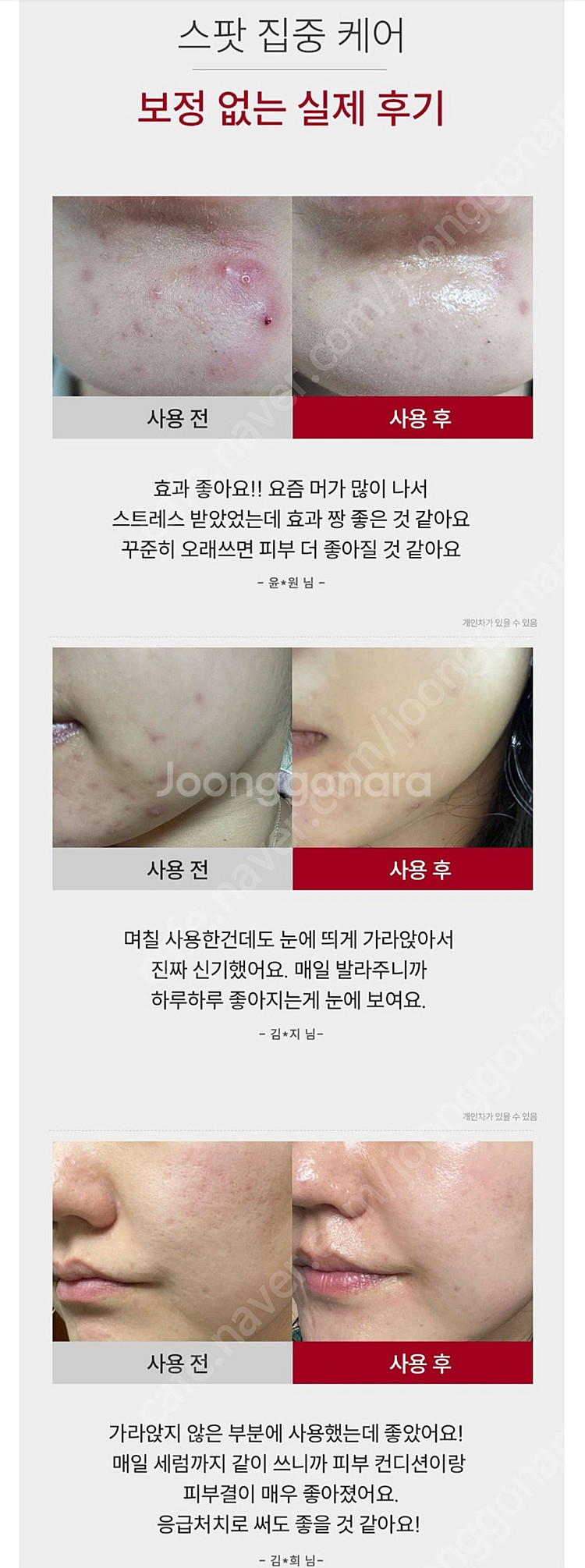 옵세로 스피큘 스팟 에센스 크림 ( 트러블 여드름 진정...--3