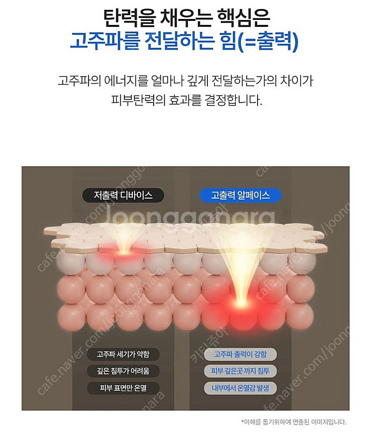 보탬 알페이스 고주파 기기--3