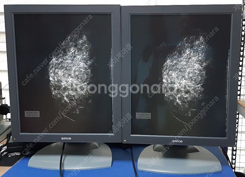 Barco(바코) 중고판독모니터 5MP 판매--1