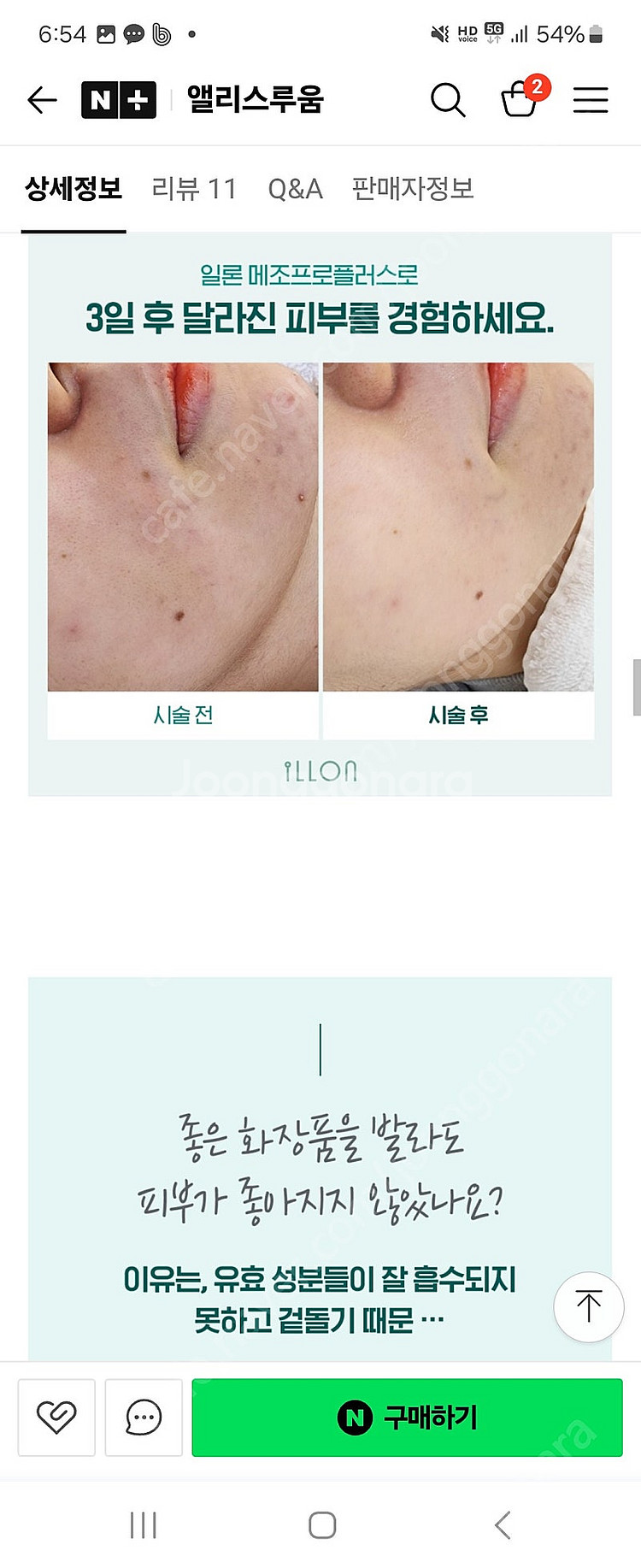 에스테틱 화장품 ㆍ더 일론 메조플러스\--4