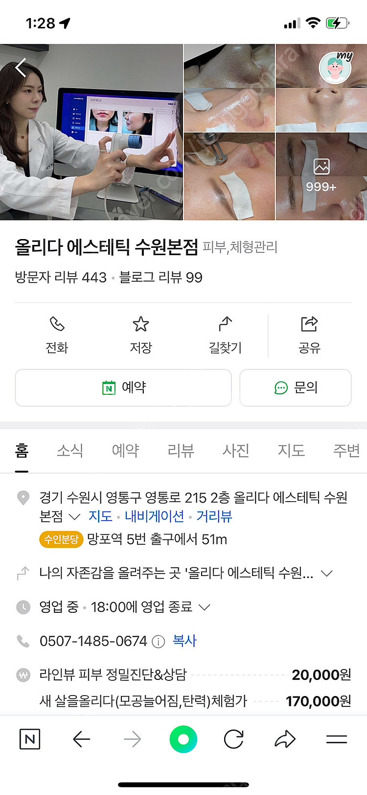 올리다에스테틱 모공/블랙해드 3회 양도권--0