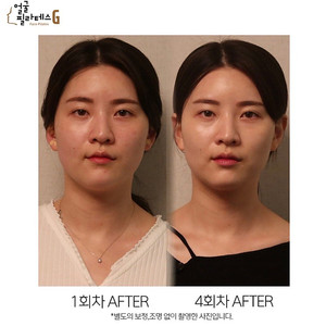 얼굴경락, 작은 얼굴관리 얼굴필라테스바이지 4회권+바디관리 1회 양도