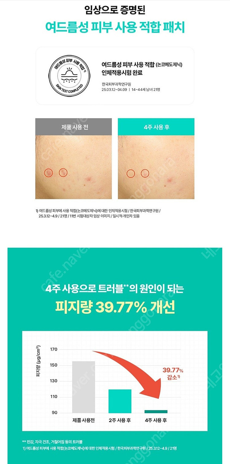 엑소좀 마이크로니들 여드름 스팟 패치 이미지