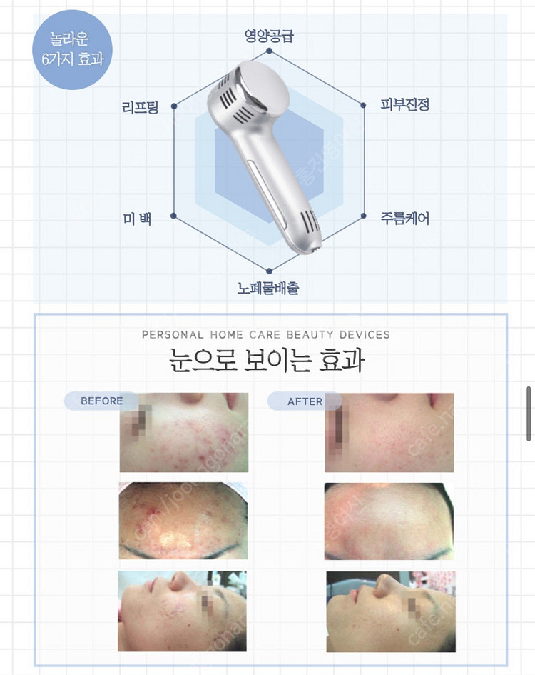 모공 수축 스마트쿨 크라이오셀--6