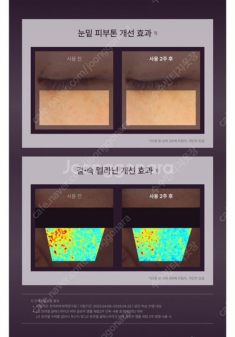 [새상품] 엘지 프라엘 수퍼폼 갈바닉 부스터 미스틱화이...--7