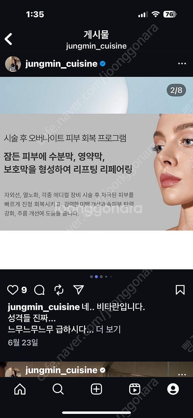 정민마켓) 엑소좀 피디알엔 슬리핑캡슐크림 새거 5개 빠...--3