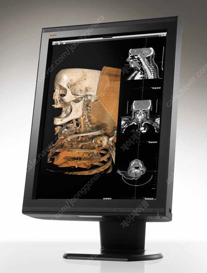 WIDE(와이드) 중고판독모니터 LED 3MP 컬러 판매 이미지