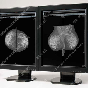 WIDE(와이드) 중고판독모니터 LED 5MP 판매 이미지