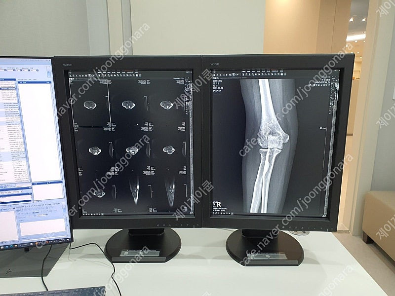 WIDE(와이드) 중고판독모니터 LED 5MP 판매 이미지