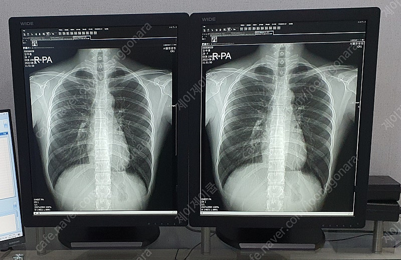 WIDE 신형(와이드) 중고판독모니터 LED 5MP 판매 이미지