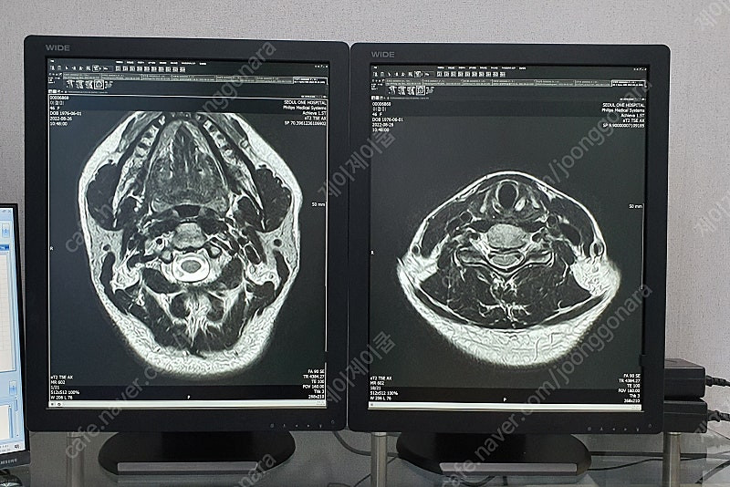 WIDE 신형(와이드) 중고판독모니터 LED 5MP 판매 이미지