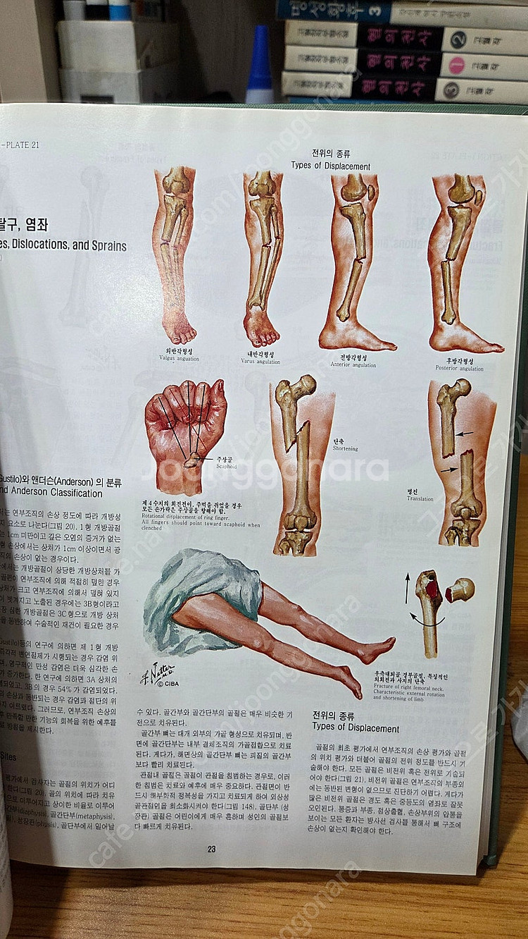 CIBA 원색도해의학총서 전13권 특A급 택포--4